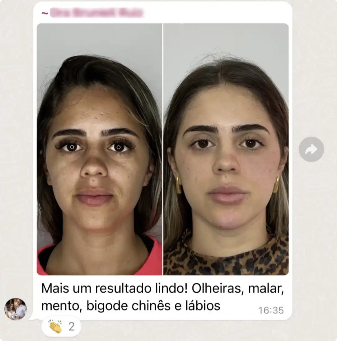 Brunieli fep 9