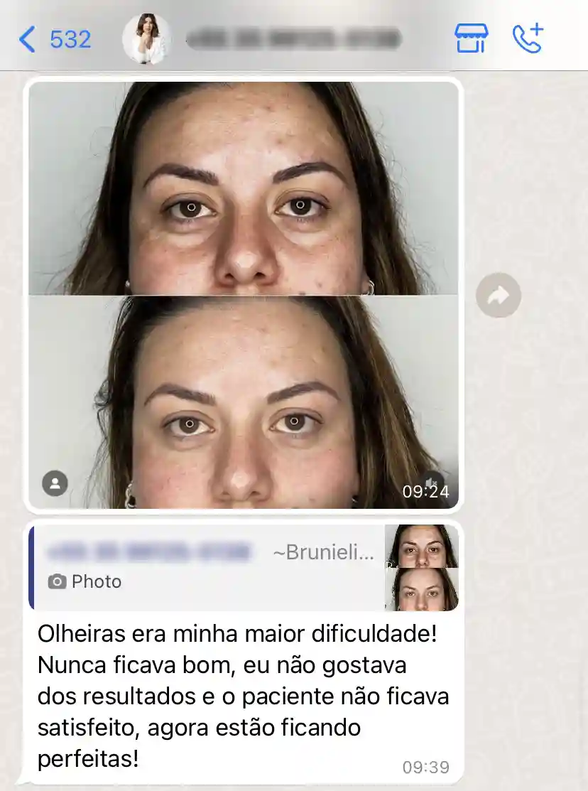 Brunieli w fep 9